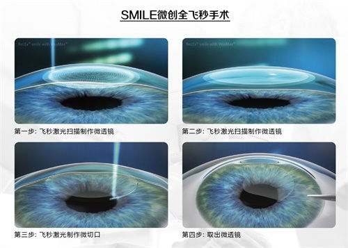 眼科謠言，你的“好心轉(zhuǎn)載”辦了多少壞事